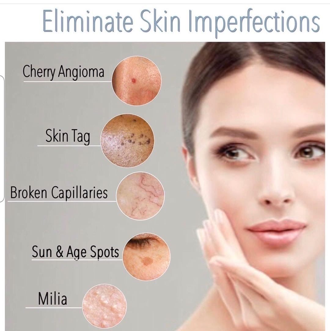 Skin classic imperfections